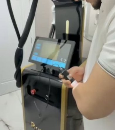 Setting up a ROOTX laser